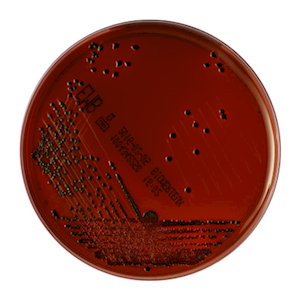 Prepared Plated Media, Eosin Methylene Blue (EMB) Agar Plates, 10 Pieces/Pack Pack